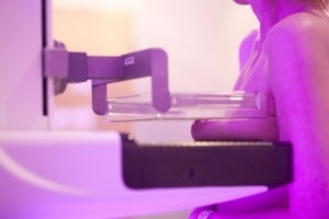 Una dona, fent-se una mamografia, una de les proves amb qu&egrave; es detecta el c&agrave;ncer de mama