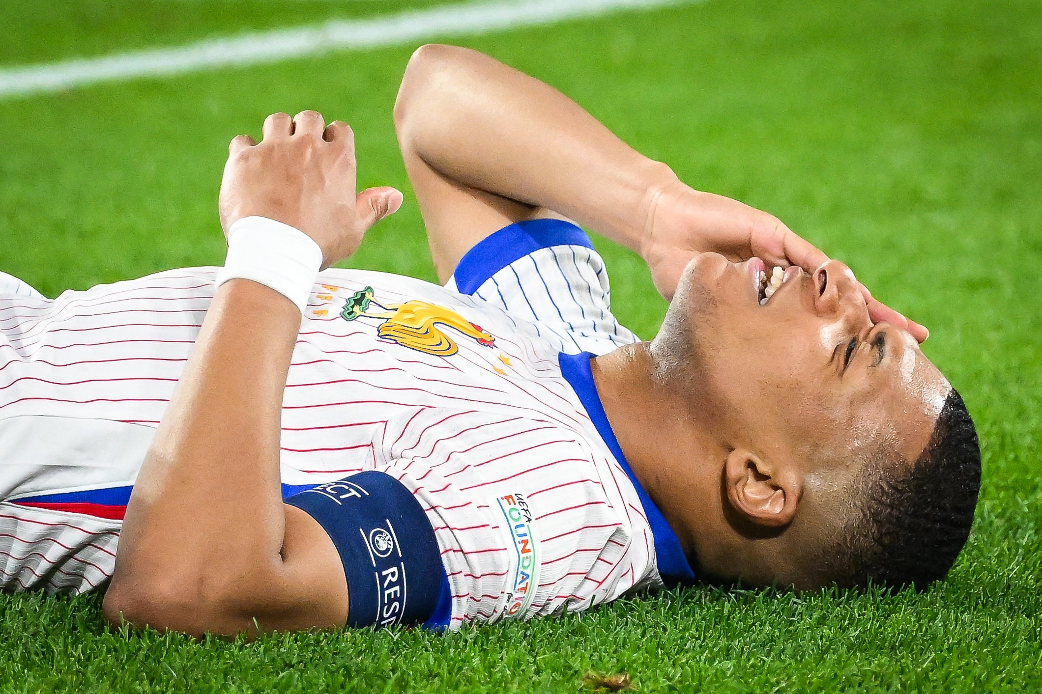 Mbappé, adolorit just després del cop que li ha trencat el nas | Europa Press