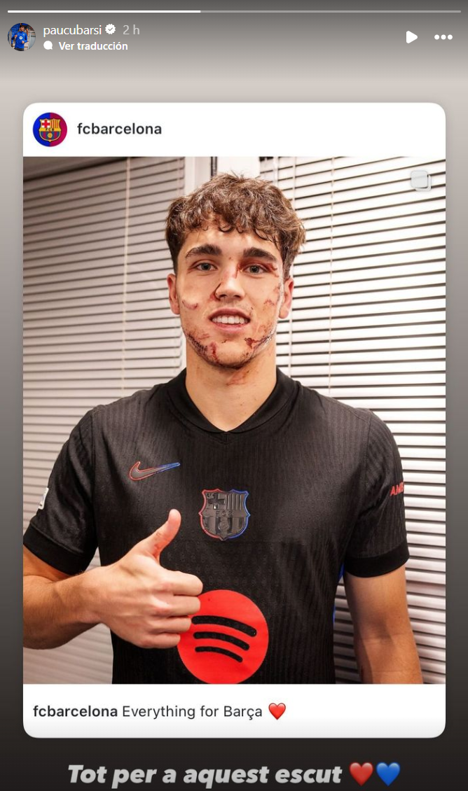 Primeres paraules de Cubarsí després de l&rsquo;aparatós trau